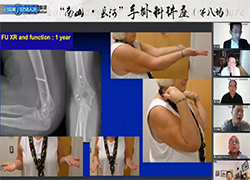 南山·长河手外科国际讲座第8场精彩回顾